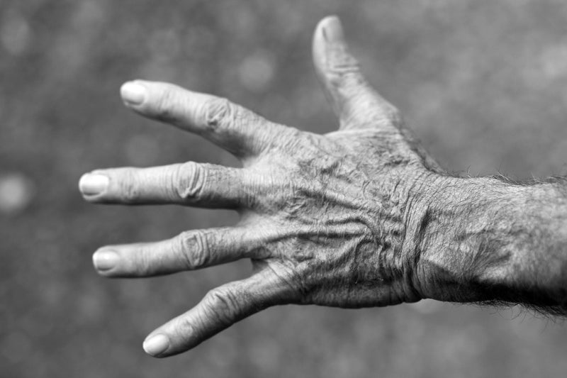 CBD for Arthritis